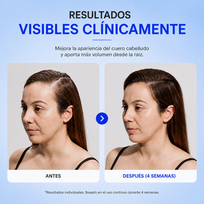 Orzenate™ Serum de Cabello Coreano