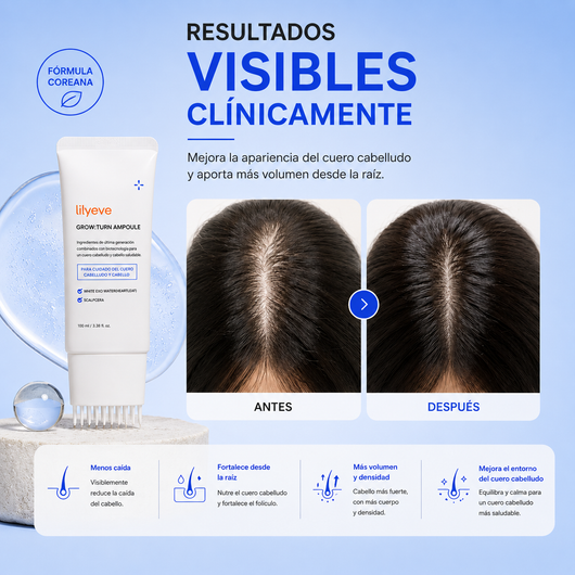 Orzenate™ Serum de Cabello Coreano