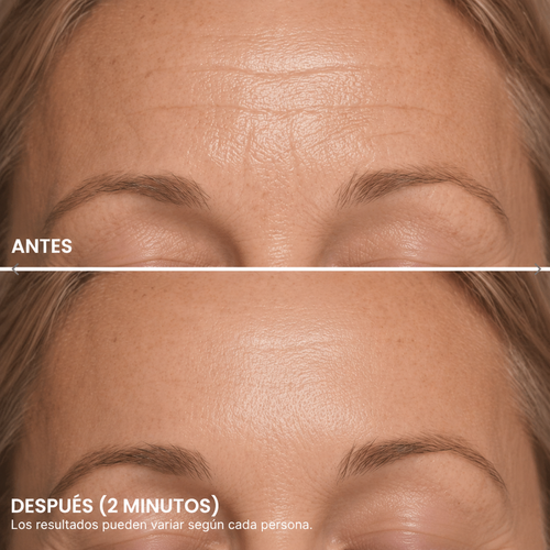 Orzenate™ Contorno de Ojos Efecto Tensor Instantáneo